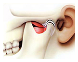 TMJ Treatments